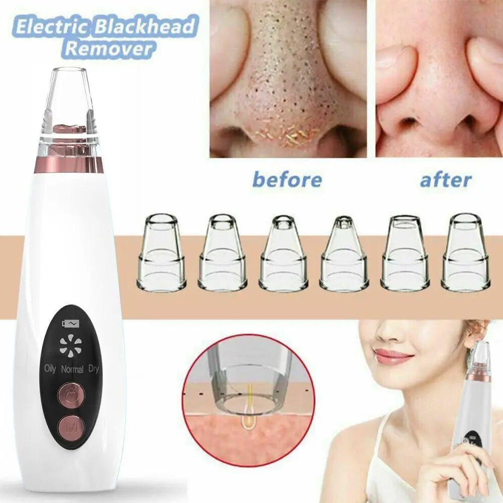 Extracteur de Points Noirs Portatif - 3 Modes de Succion avec USB Rechargeable