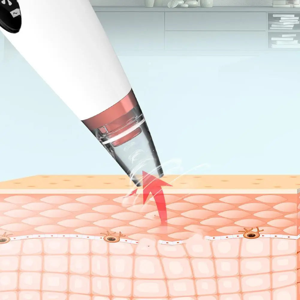 Extracteur de Points Noirs Portatif - 3 Modes de Succion avec USB Rechargeable